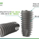 Trụ implant Hàn Quốc Trồng răng giá tốt nhất Hà Nội