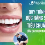 Hiểu rõ quy trình bọc răng sứ để có lựa chọn đúng