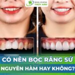 Có nên bọc răng sứ nguyên hàm không?